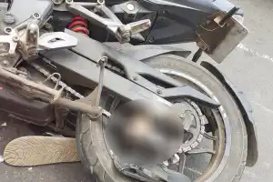 யாழ். மோ. சைக்கிள் விபத்தில்   ஒருவரின் கால் பாதம் துண்டிப்பு