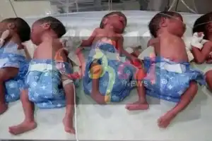 யாழ். போதனா வைத்தியசாலையில் ஒரே சூழில் பிறந்த ஐந்து குழந்தைகள்